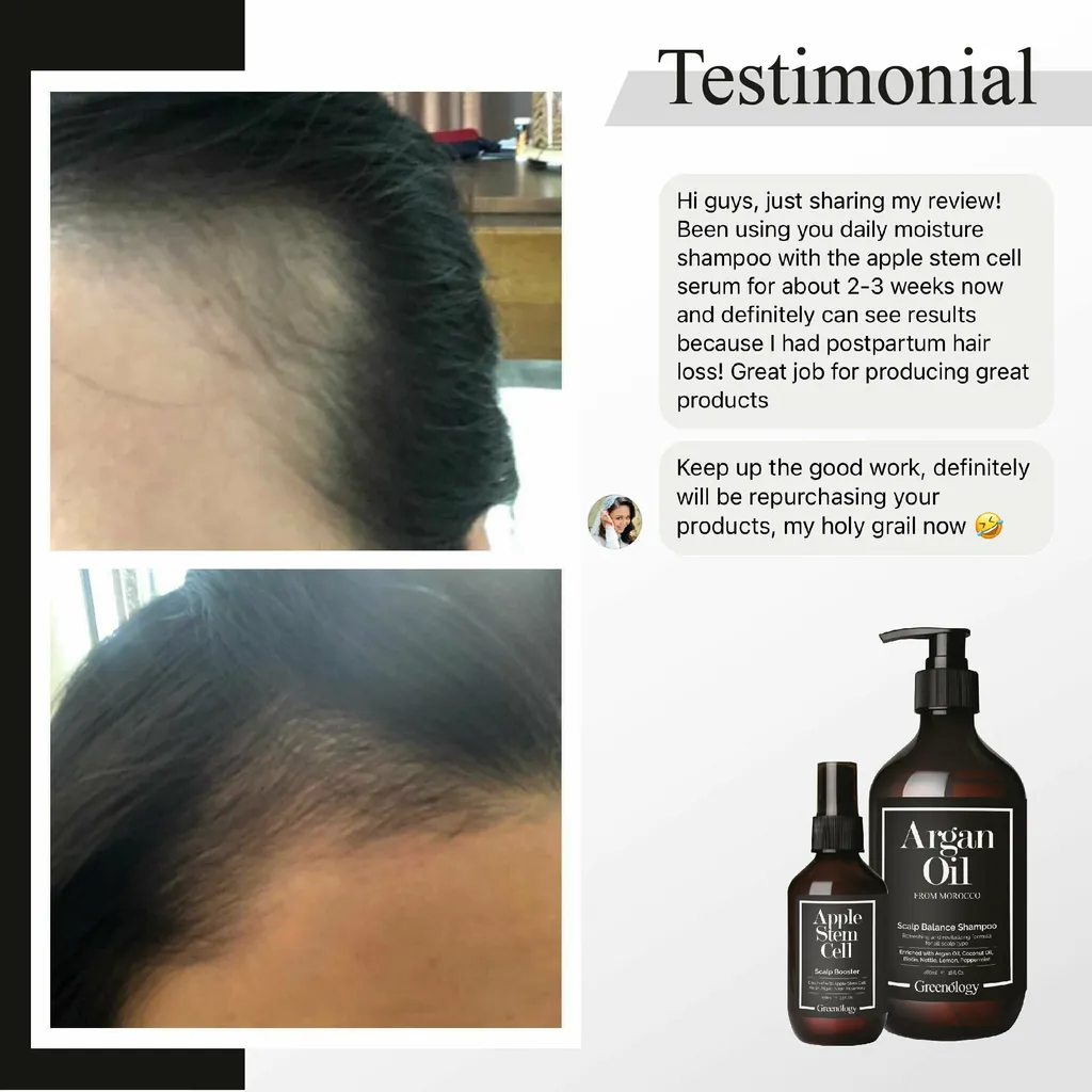 Greenology_Apple Stem Cell Scalp Booster_Product Description-09.jpg