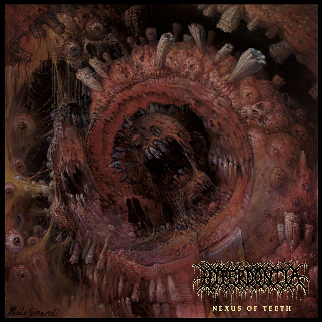 Hyperdontia-Nexus-of-Teeth