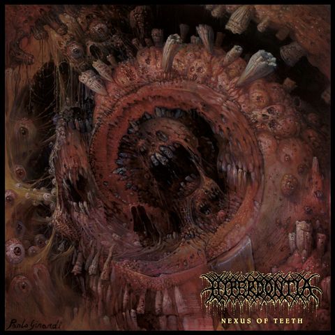Hyperdontia-Nexus-of-Teeth