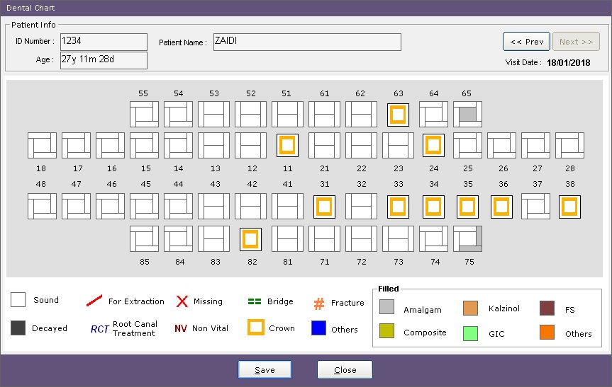 Dental-Chart-Dental-Management-Software-DMS-Crown