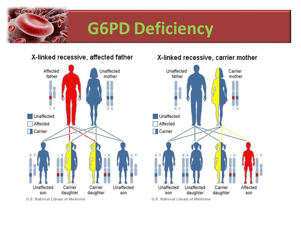 12 Pantang Larang Jika Anak ada G6PD Deficiency – Bundles 