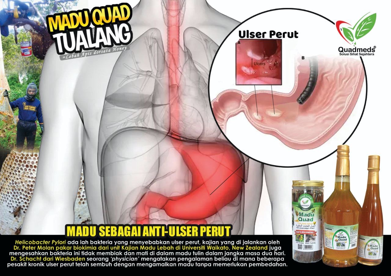 Sembuh gastrik dengan madu 2.jpeg