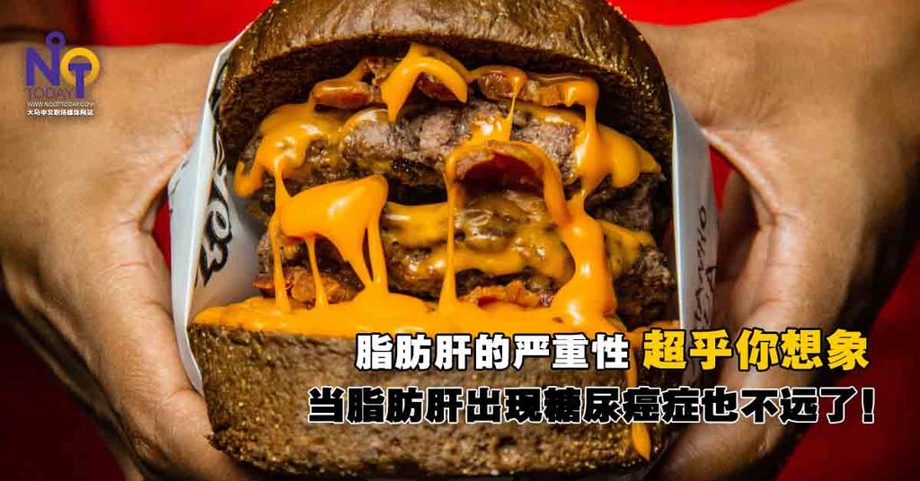 NOOTTODAY - 上班这些坏习惯养出脂肪肝:天啊!今天开始都不敢这样做了