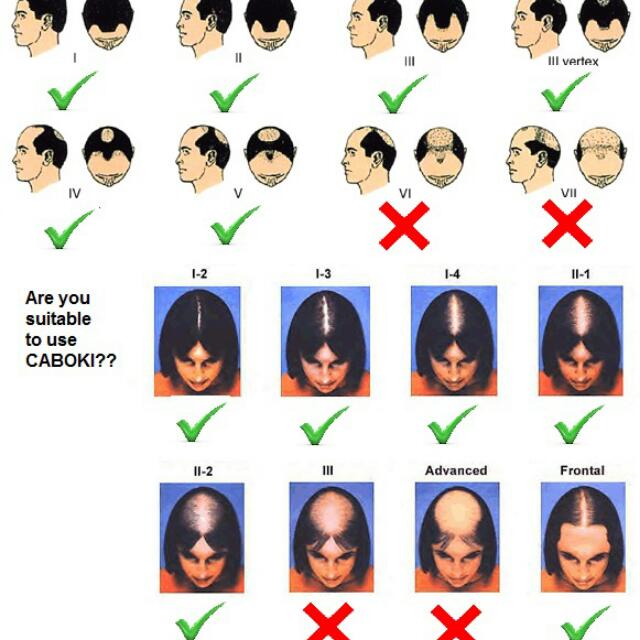 caboki_magic_hair_loss_concealer.jpg
