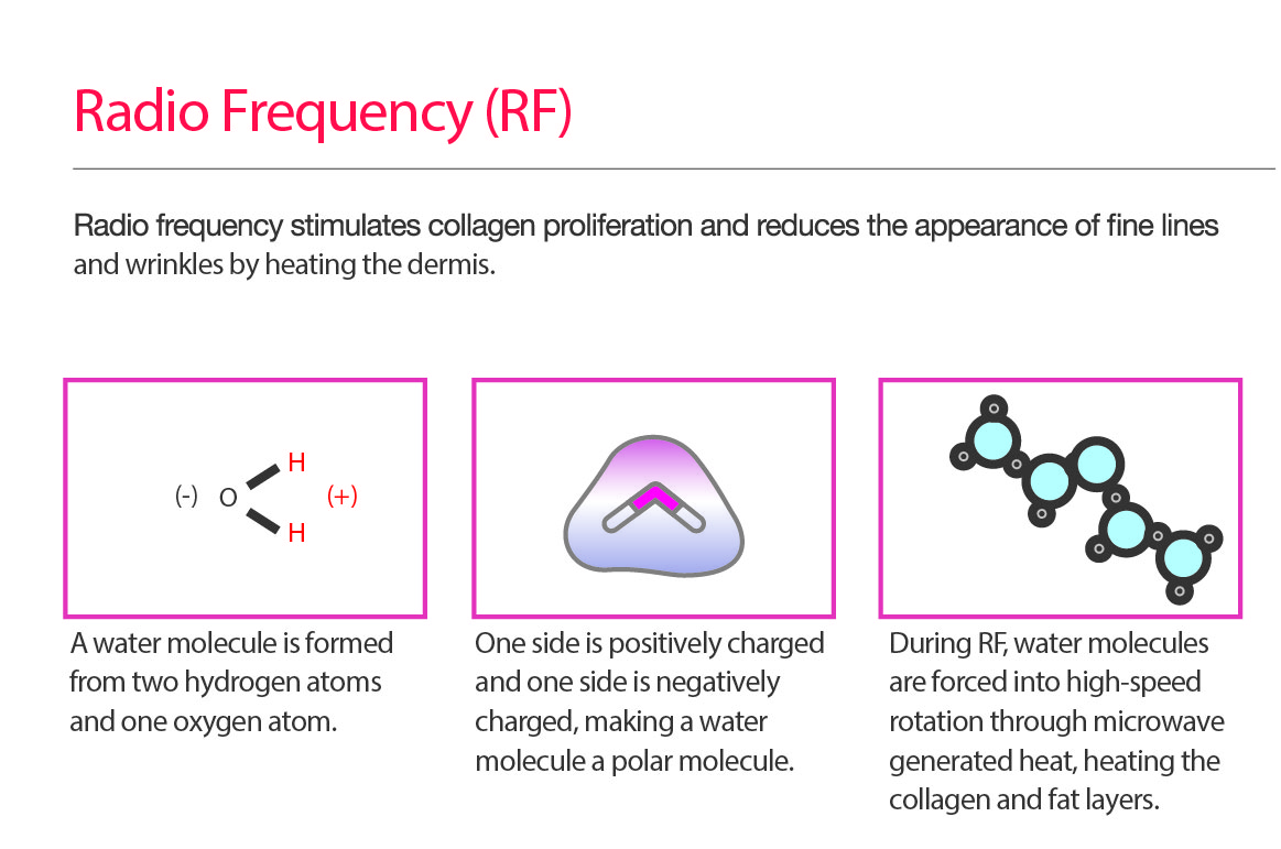 lifetrons-rf300-thermage-facial-lift-radio-frequency-energy-onedirectstore-1905-02-F612735_3.jpg