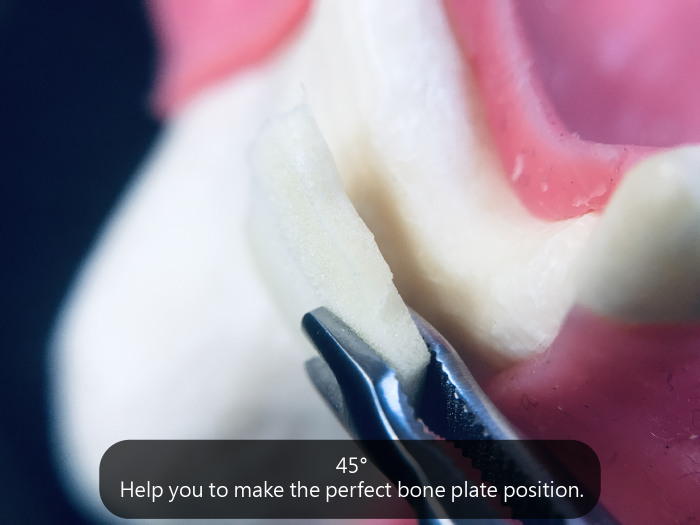 Bone Holding Forceps content-07