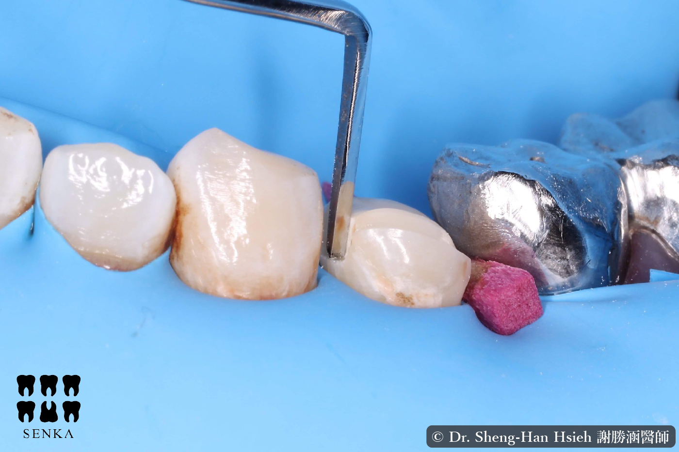 MMZ Margin Trimmer content-05.jpg