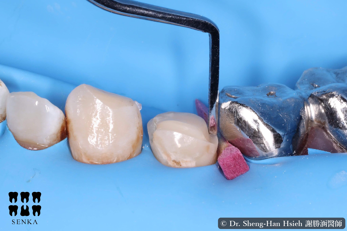 MMZ Margin Trimmer content-06.jpg