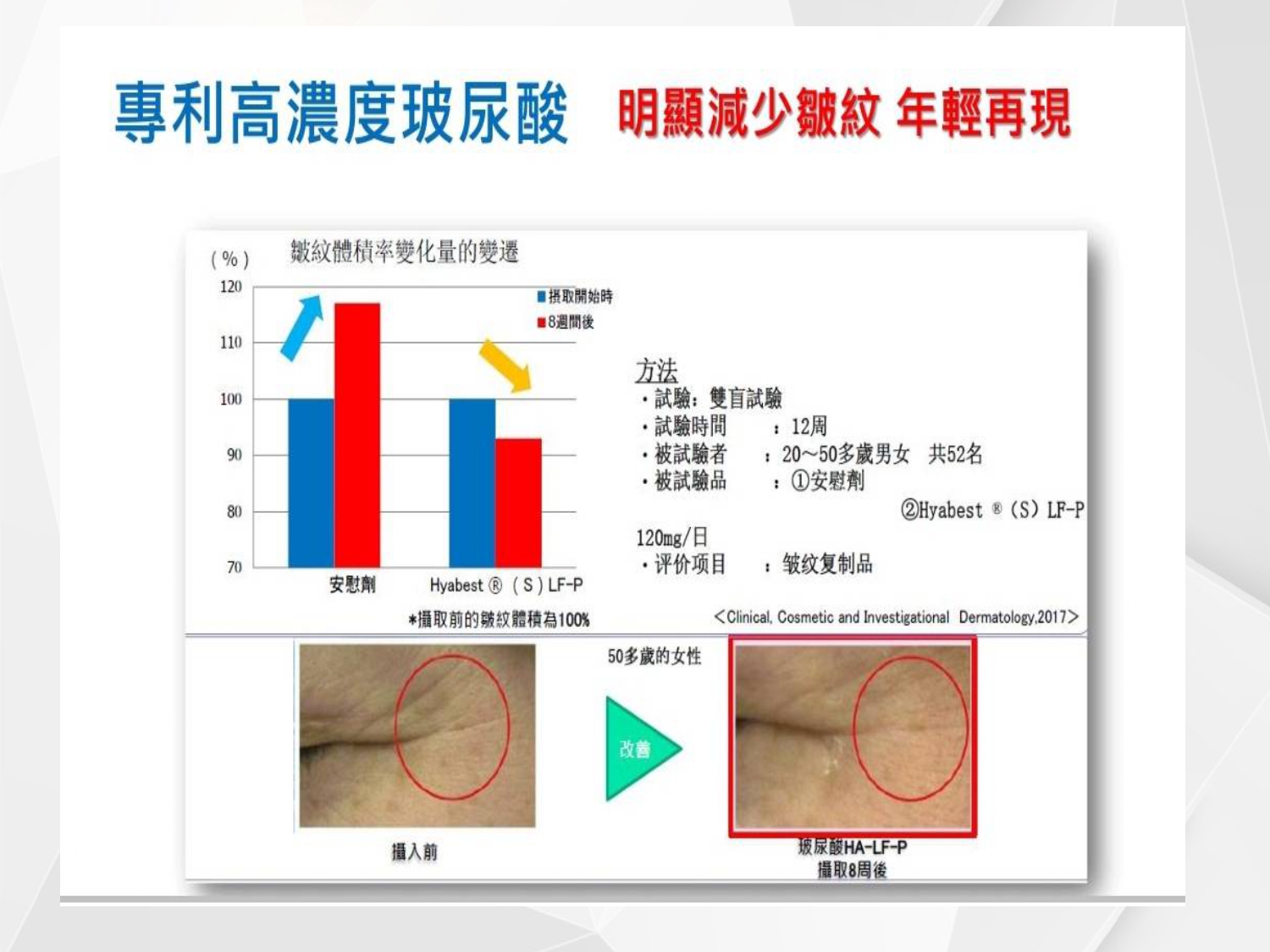 玻尿酸_04_水嫩肌膚_減少皺紋