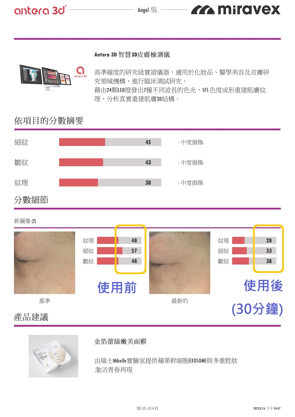 Antera 3D眼周抗老報告_01_02