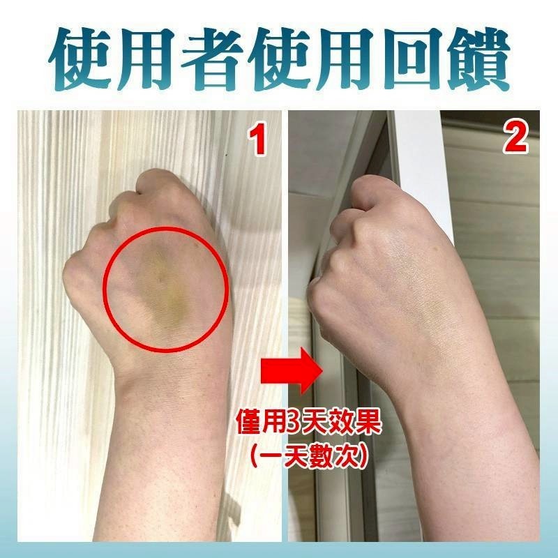 消瘀青_止癢_消腫_局部燙傷消腫_2