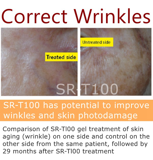 07_sr-t100_treatment_corct wrinkles.jpg