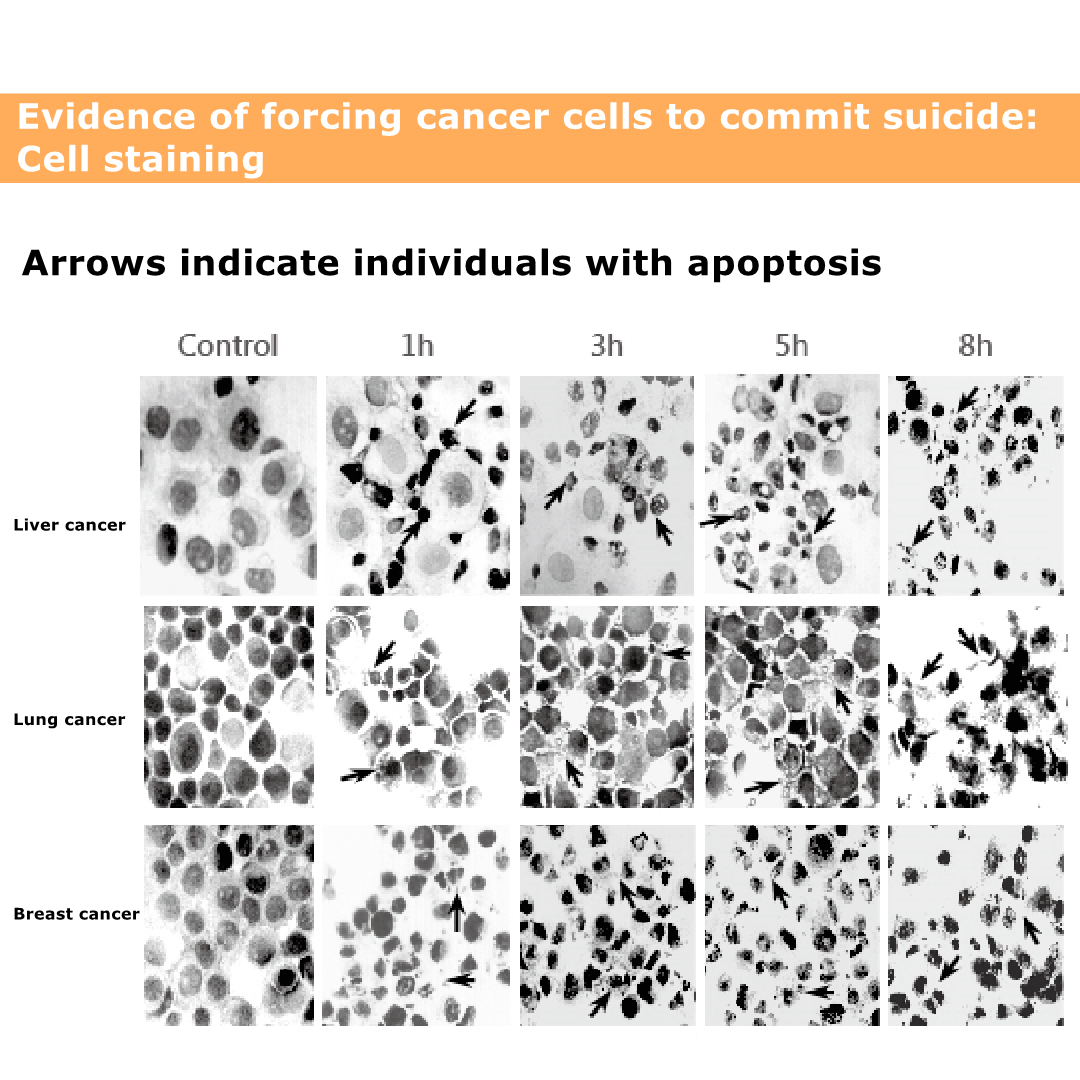 الخلية apoptosis.jpg