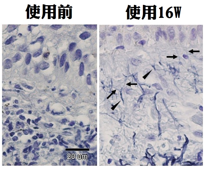 003_活化、修復彈性纖維.jpg