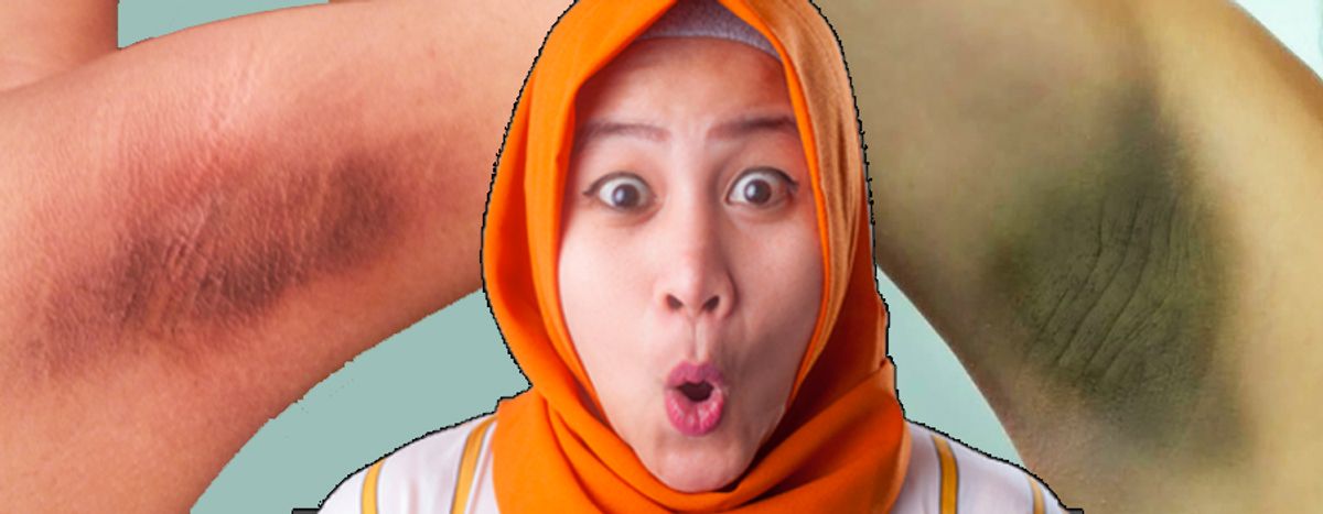 Salah Cukur & Deodorant, Ketiak Jadi Hitam