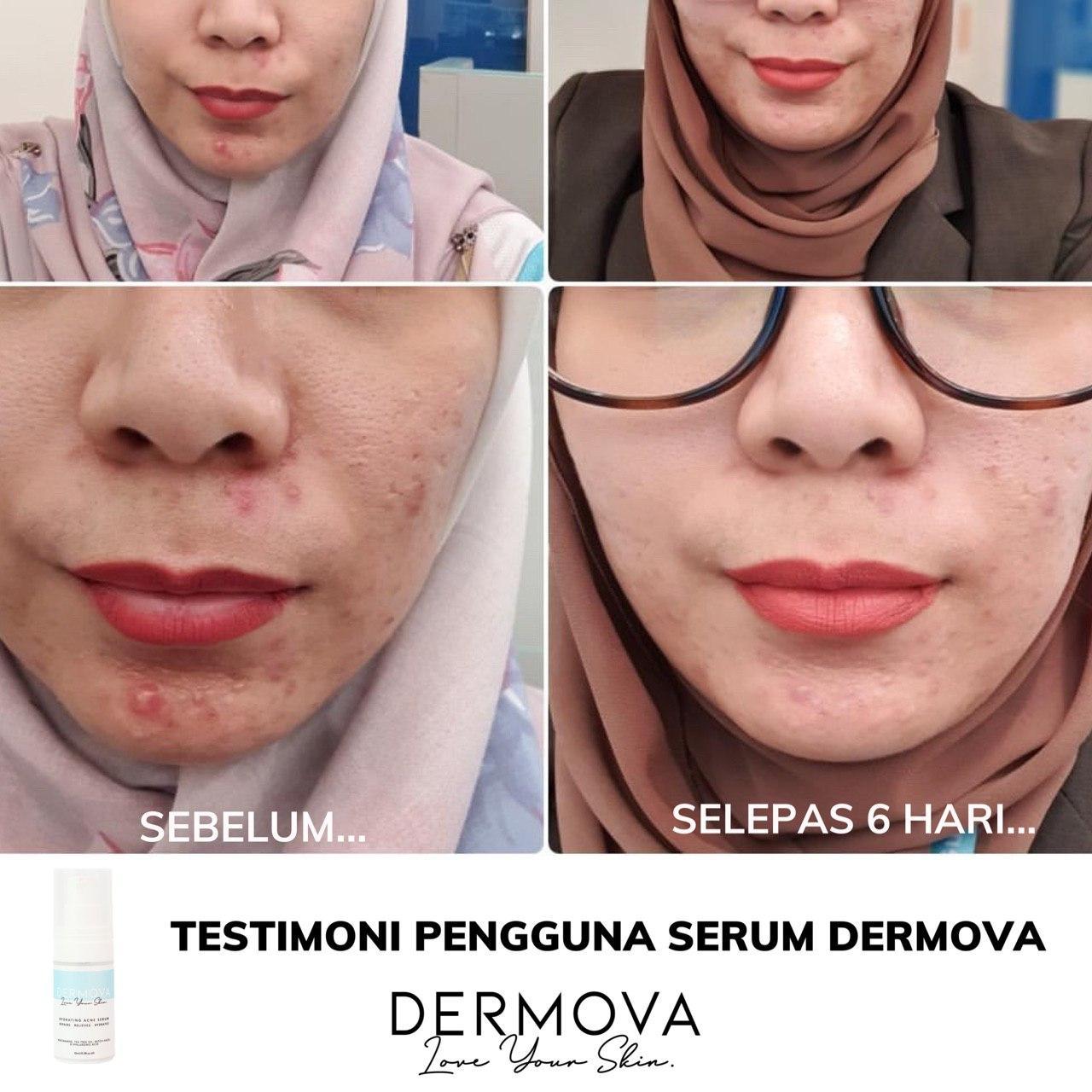 dermova serum