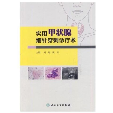 tw-11134207-7r990-lsp4wgar0vm0ca