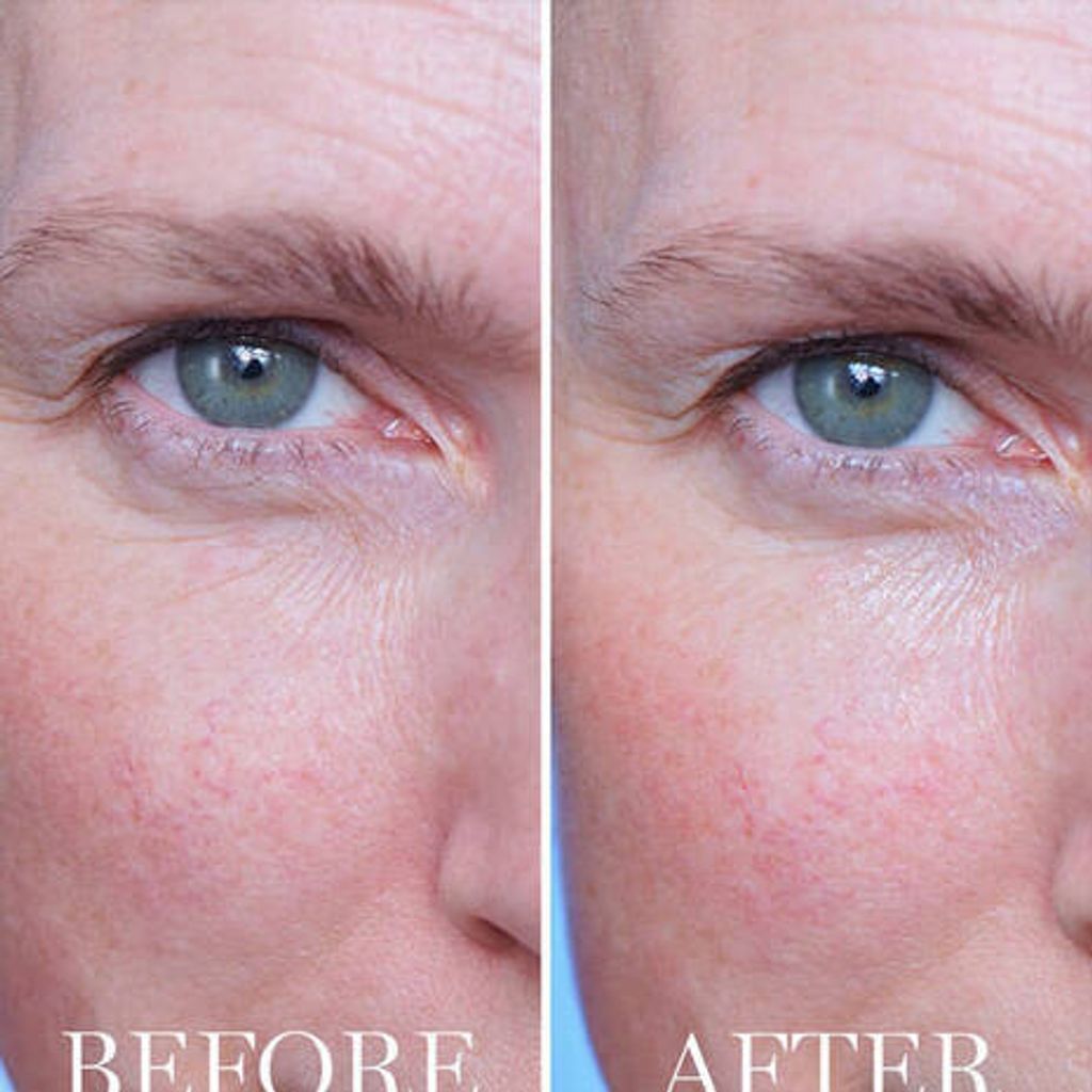 Lancome-Cream-Advanced_Genifique_Yeux-alt-4