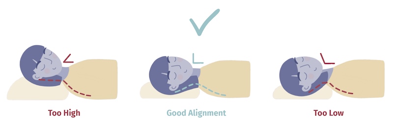 Neck_Alignment_Back_Sleeper.jpg Neck_Alignment_Back_Sleeper.jpg