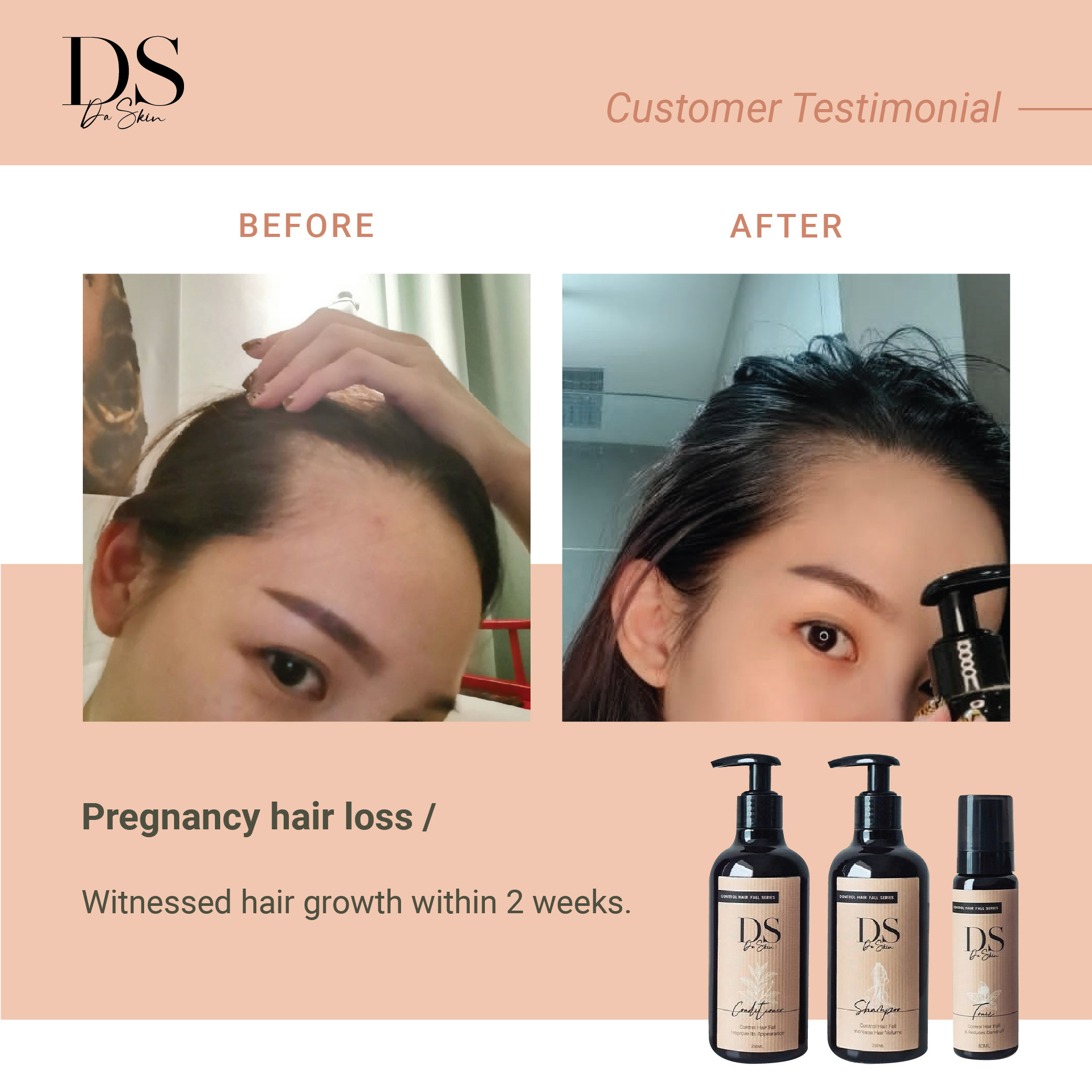 Before _ After_web-07