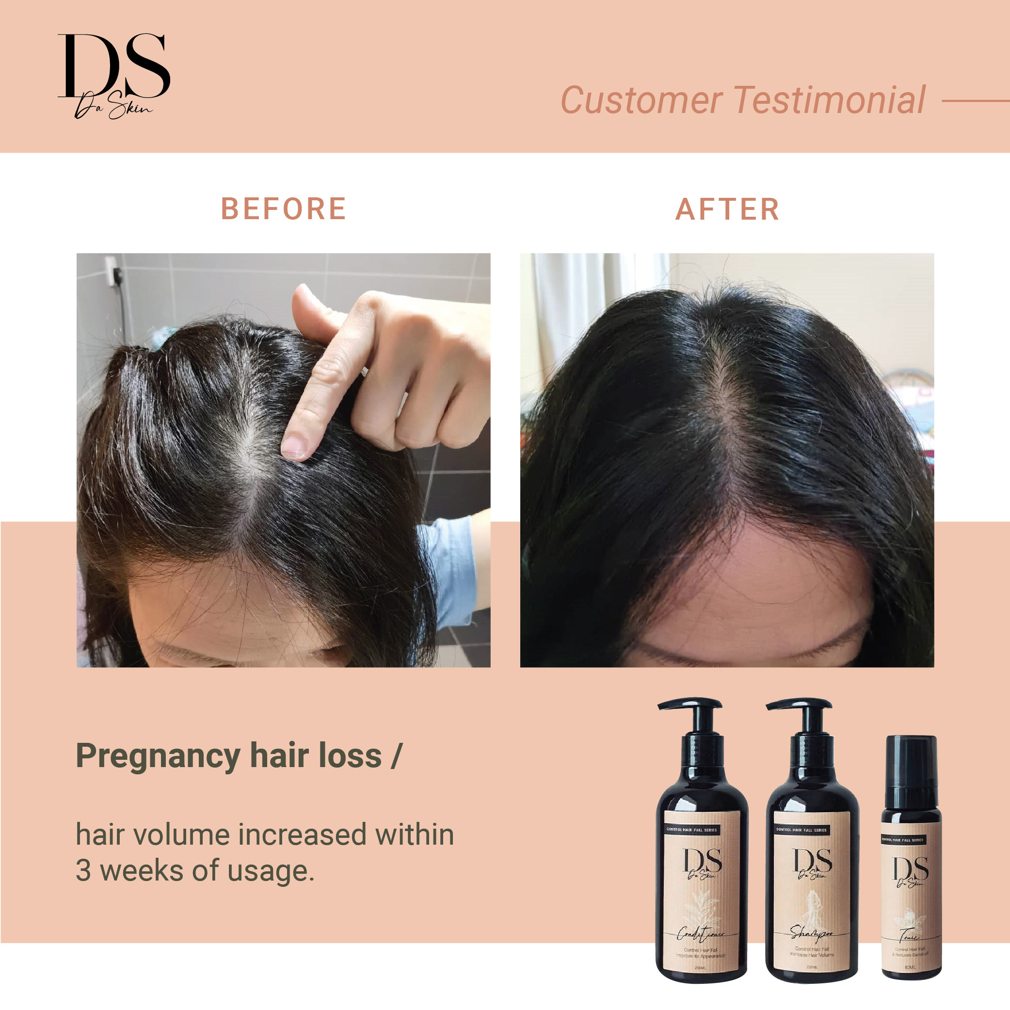 Before _ After_web-06