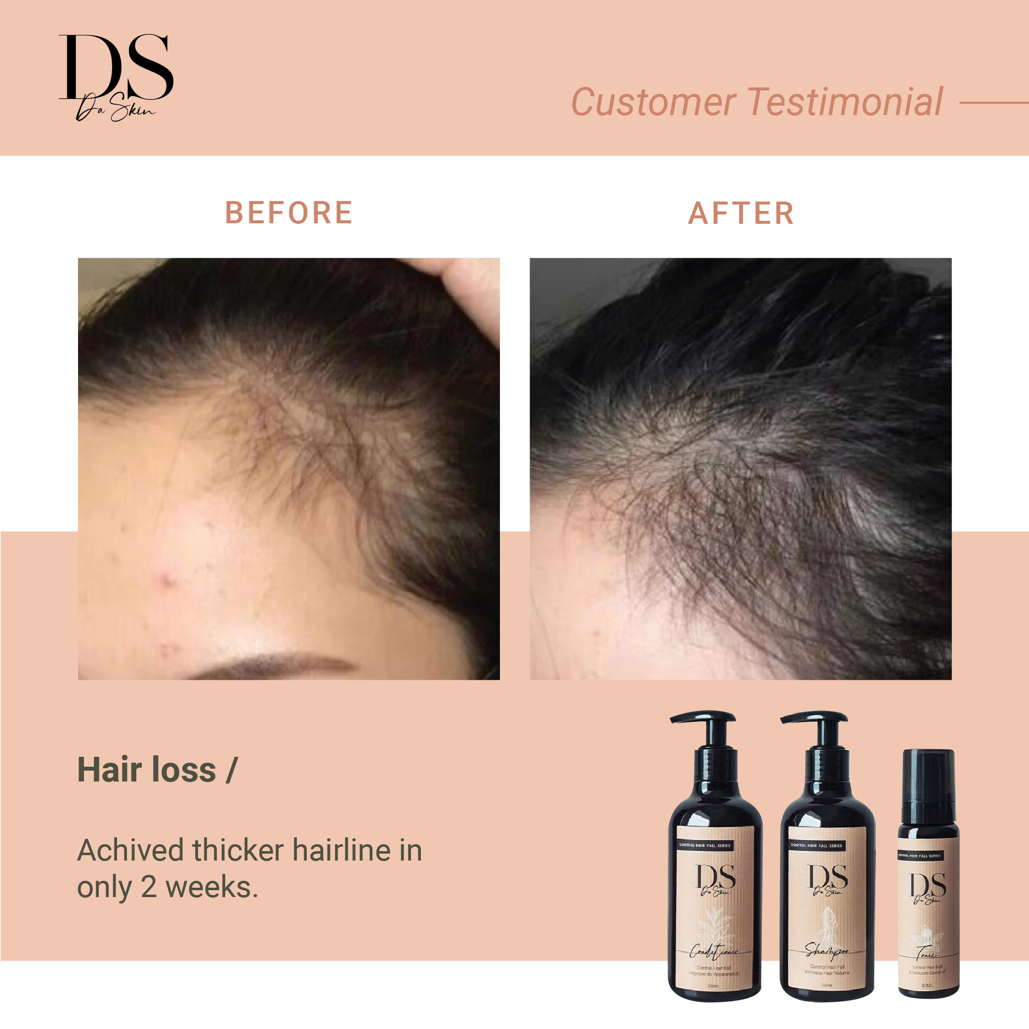 Before _ After_web-08