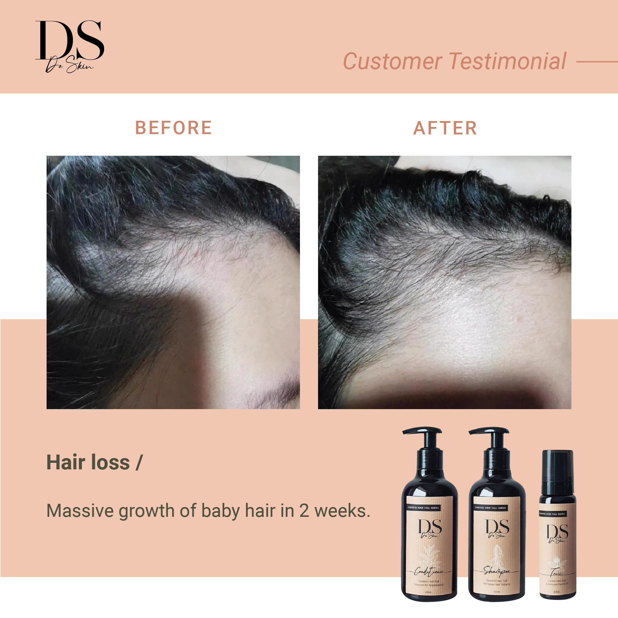 Before _ After_web-09