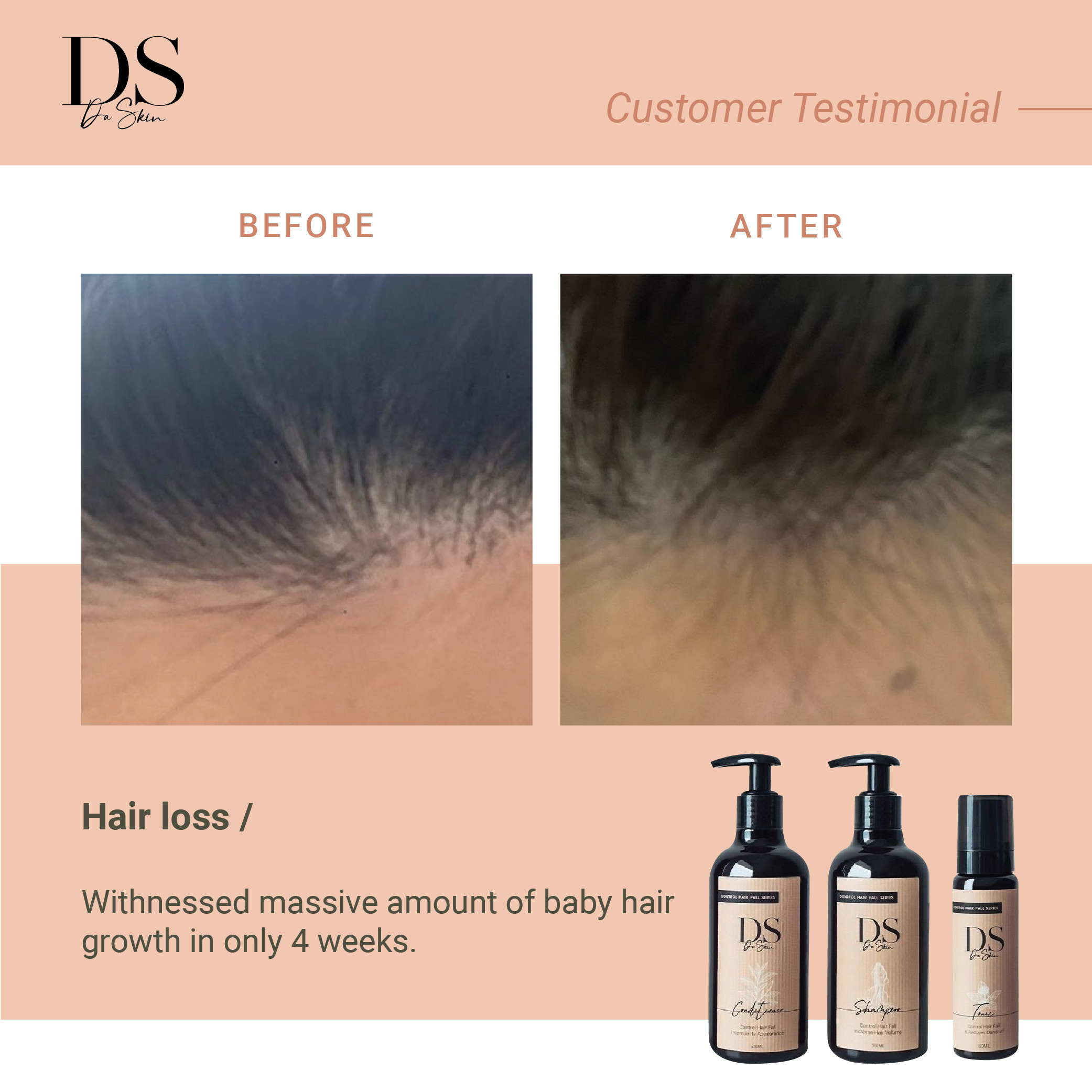 Before _ After_web-03