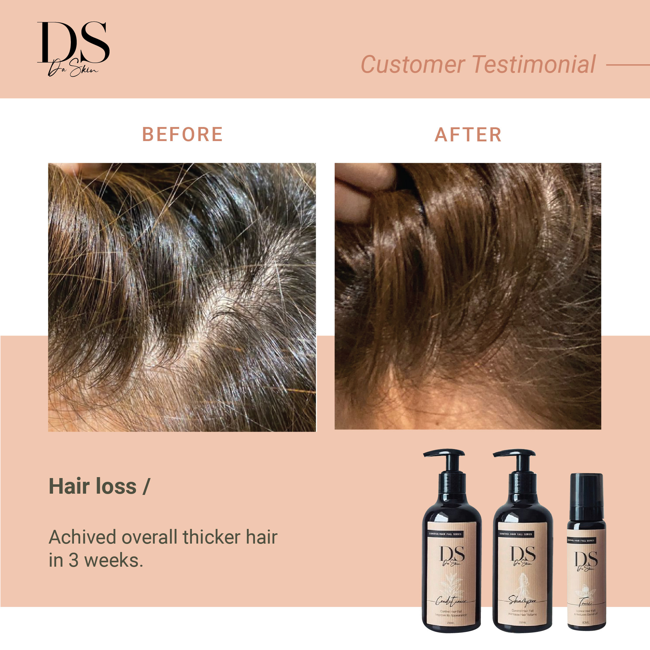 Before _ After_web-04