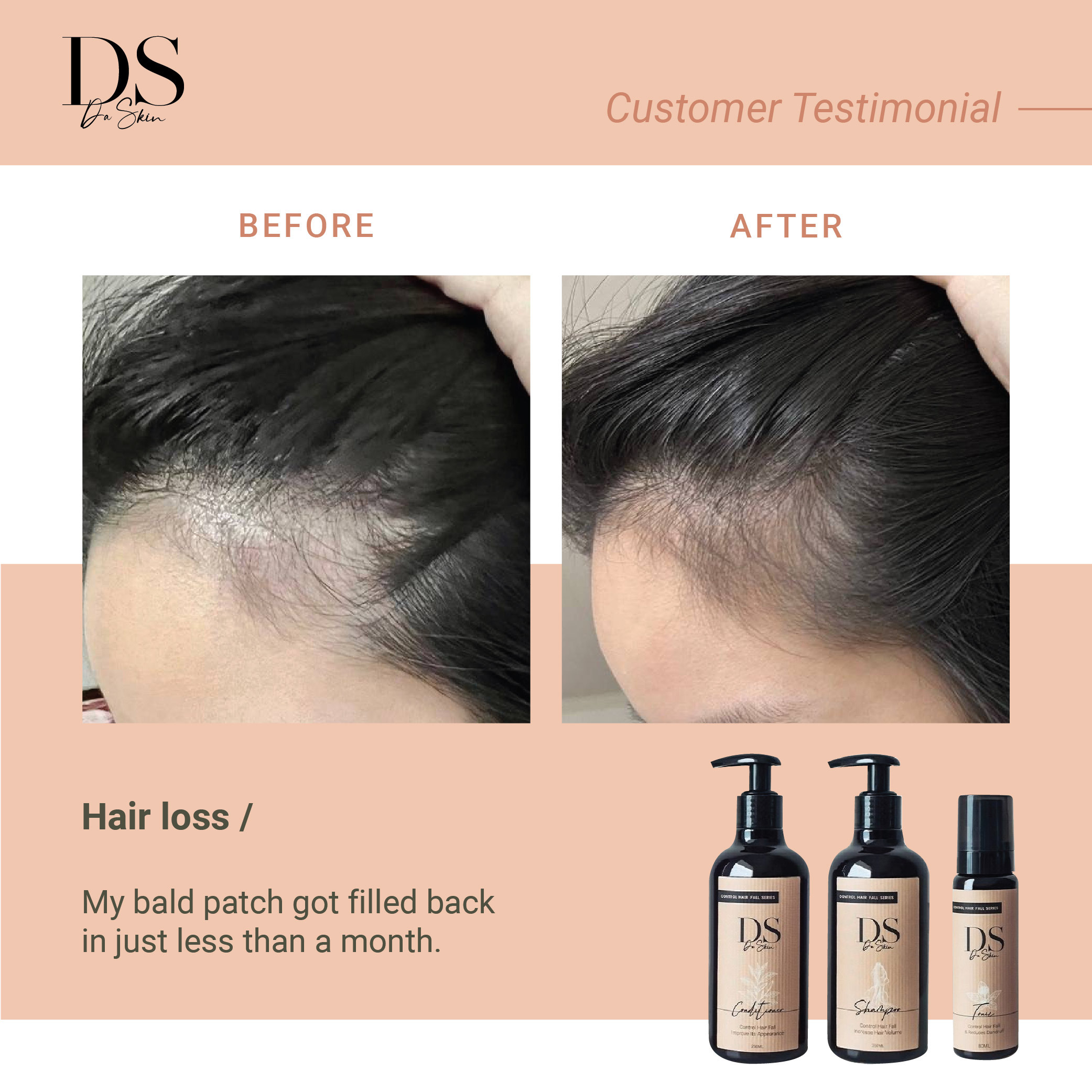 Before _ After_web-11