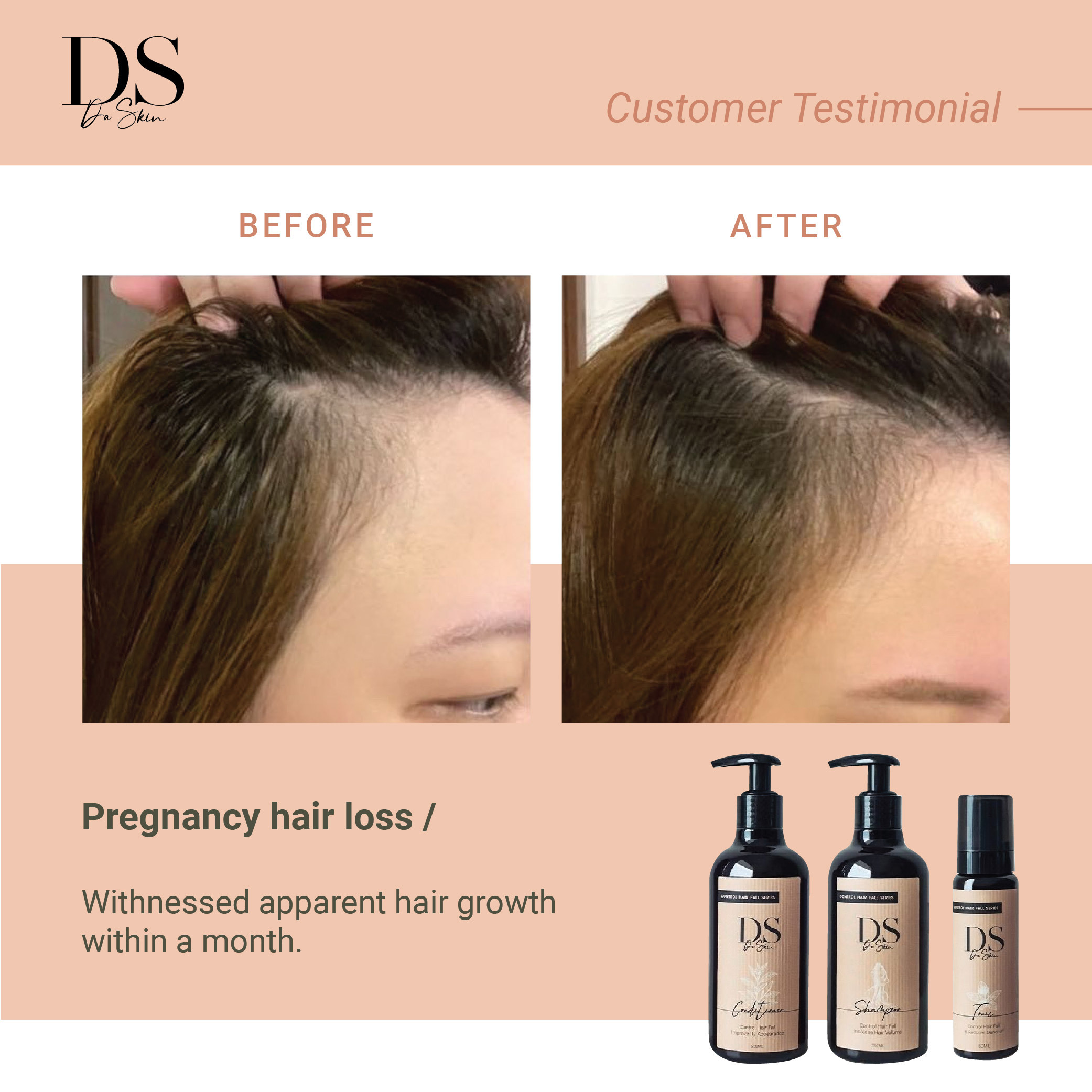 Before _ After_web-12