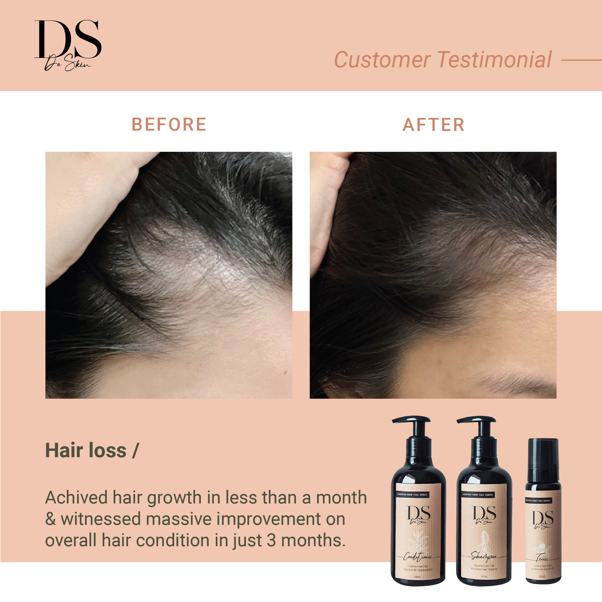 Before _ After_web-14