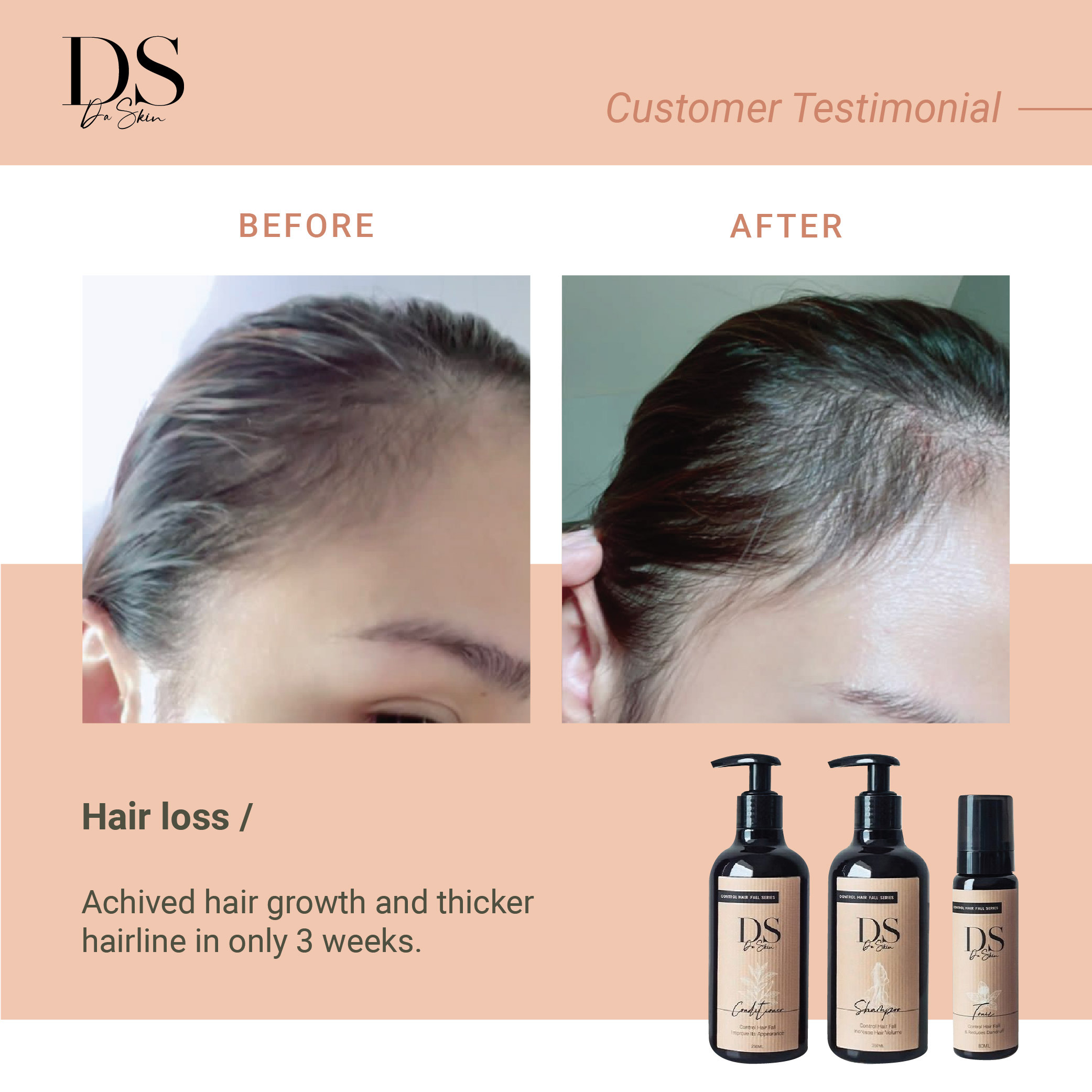 Before _ After_web-15