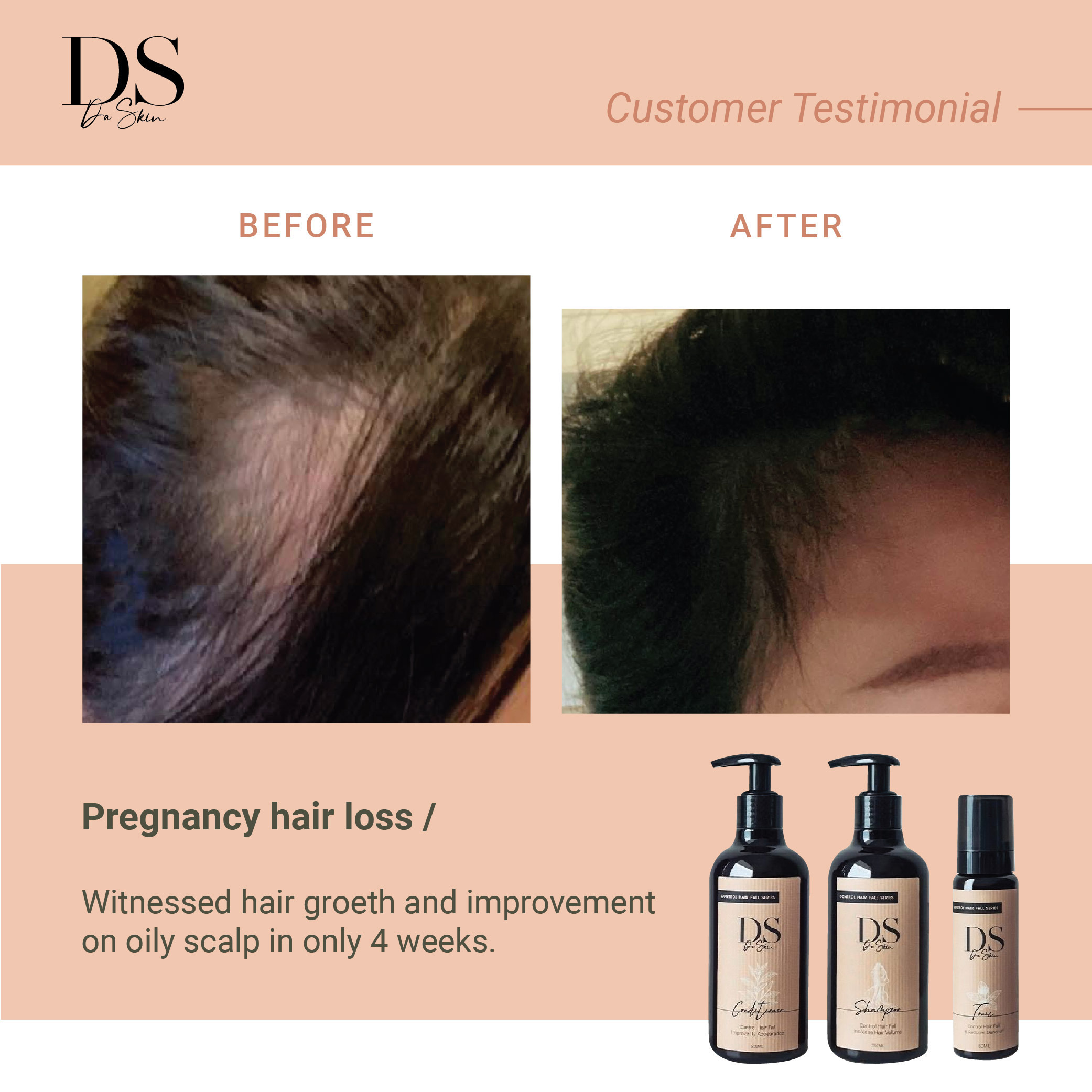 Before _ After_web-16