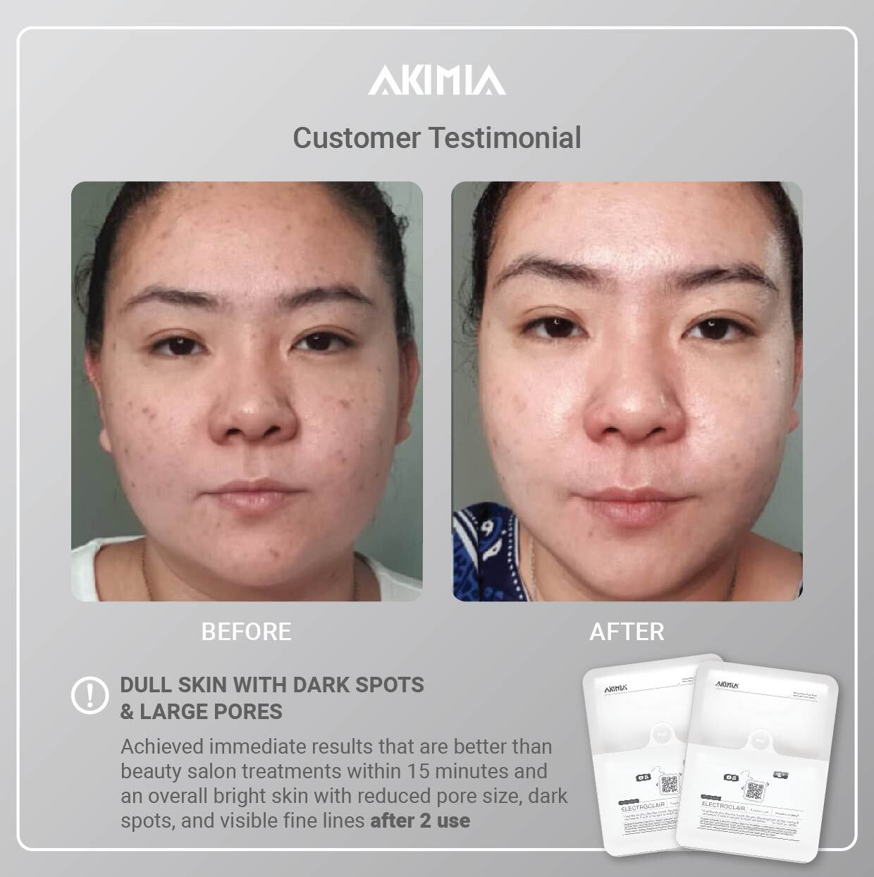 Akimia before and after_R1-02