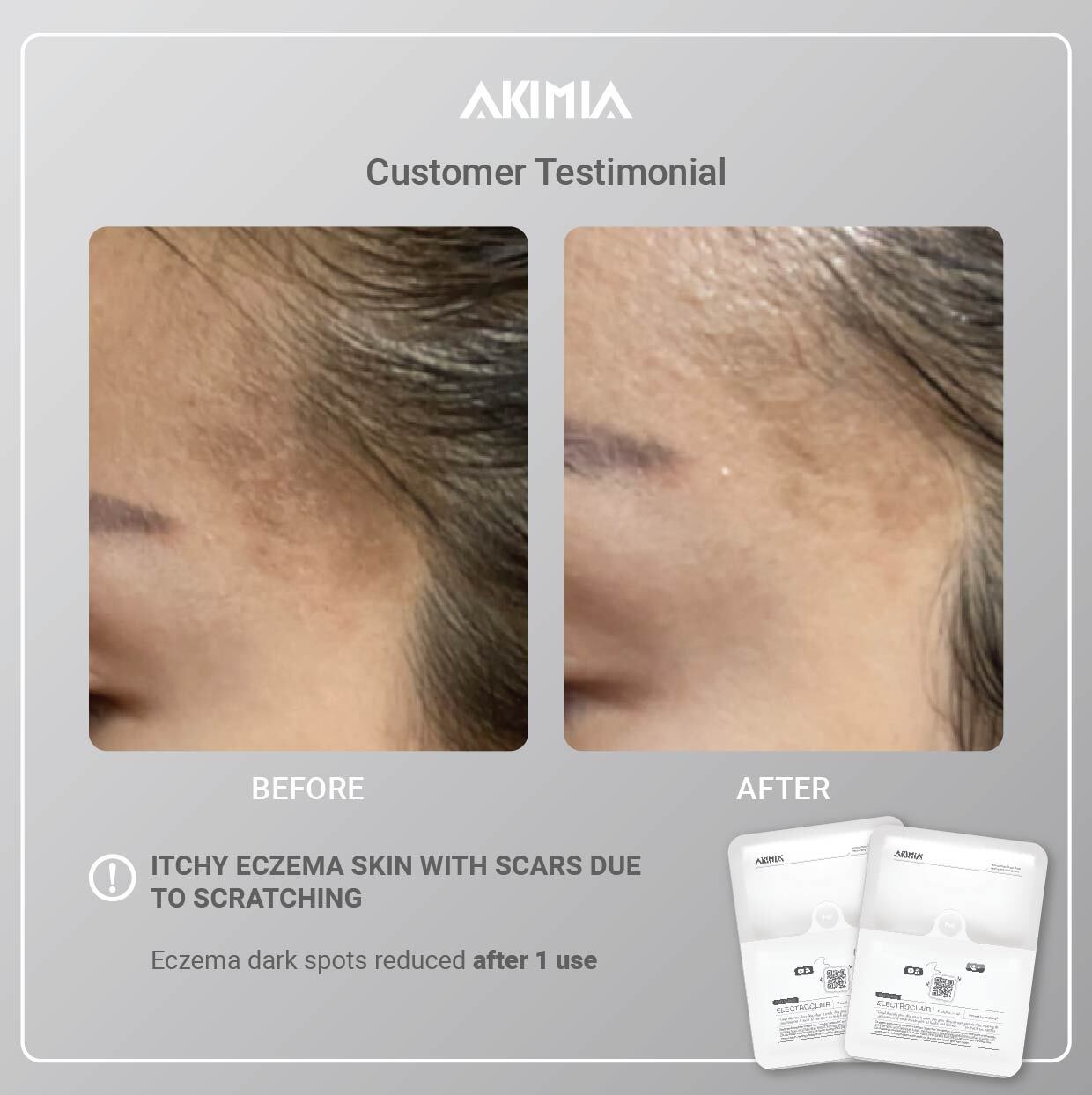 Akimia before and after_R1-01