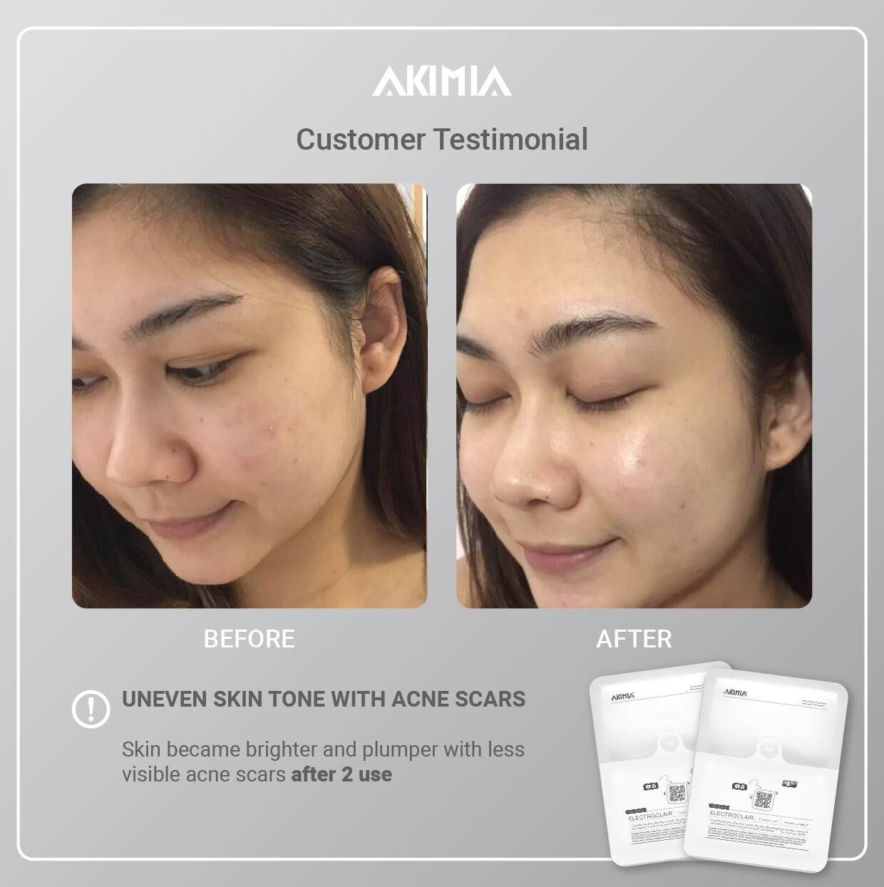 Akimia before and after_R1-03