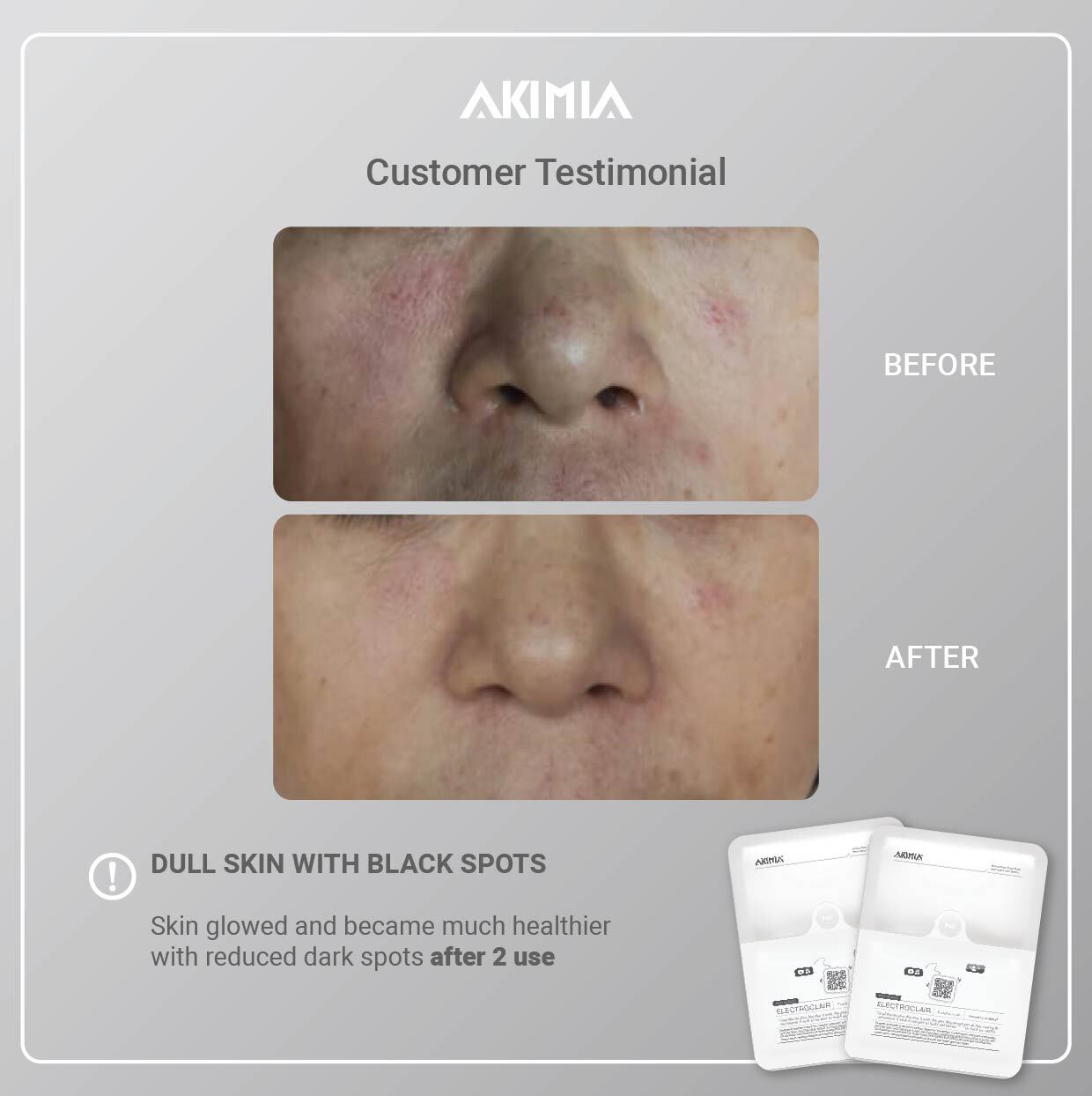 Akimia before and after_R1-04