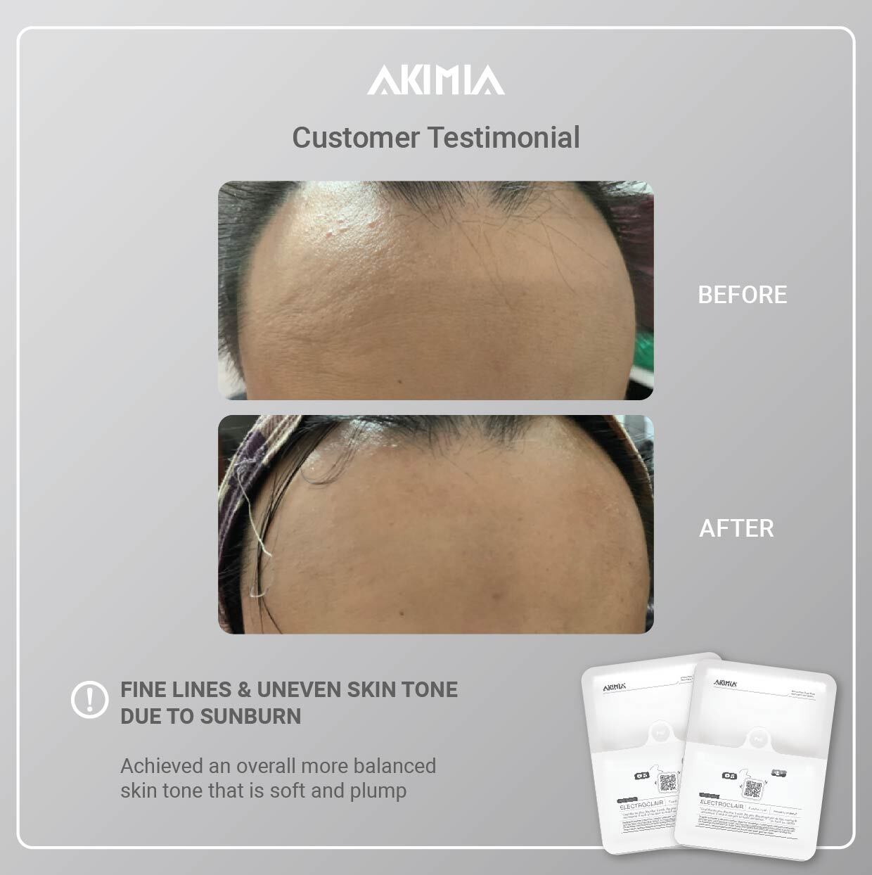 Akimia before and after_R1-05