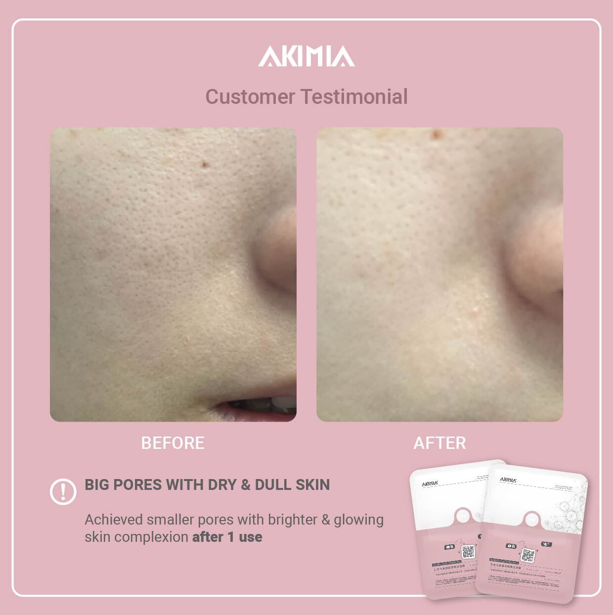 Akimia before and after_R1-07