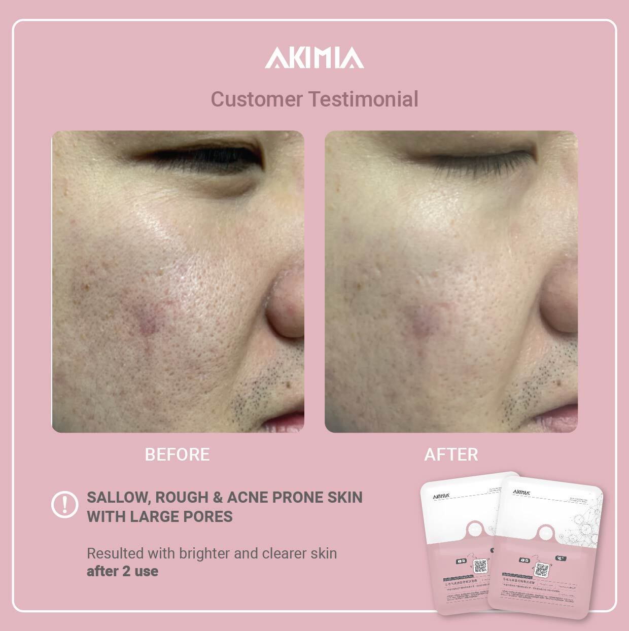 Akimia before and after_R1-09