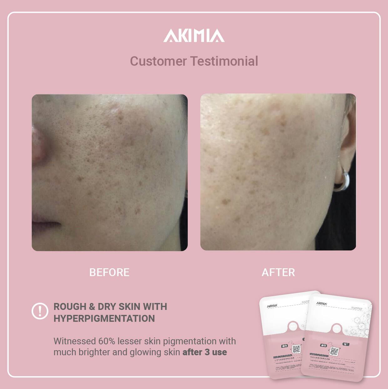 Akimia before and after_R1-10