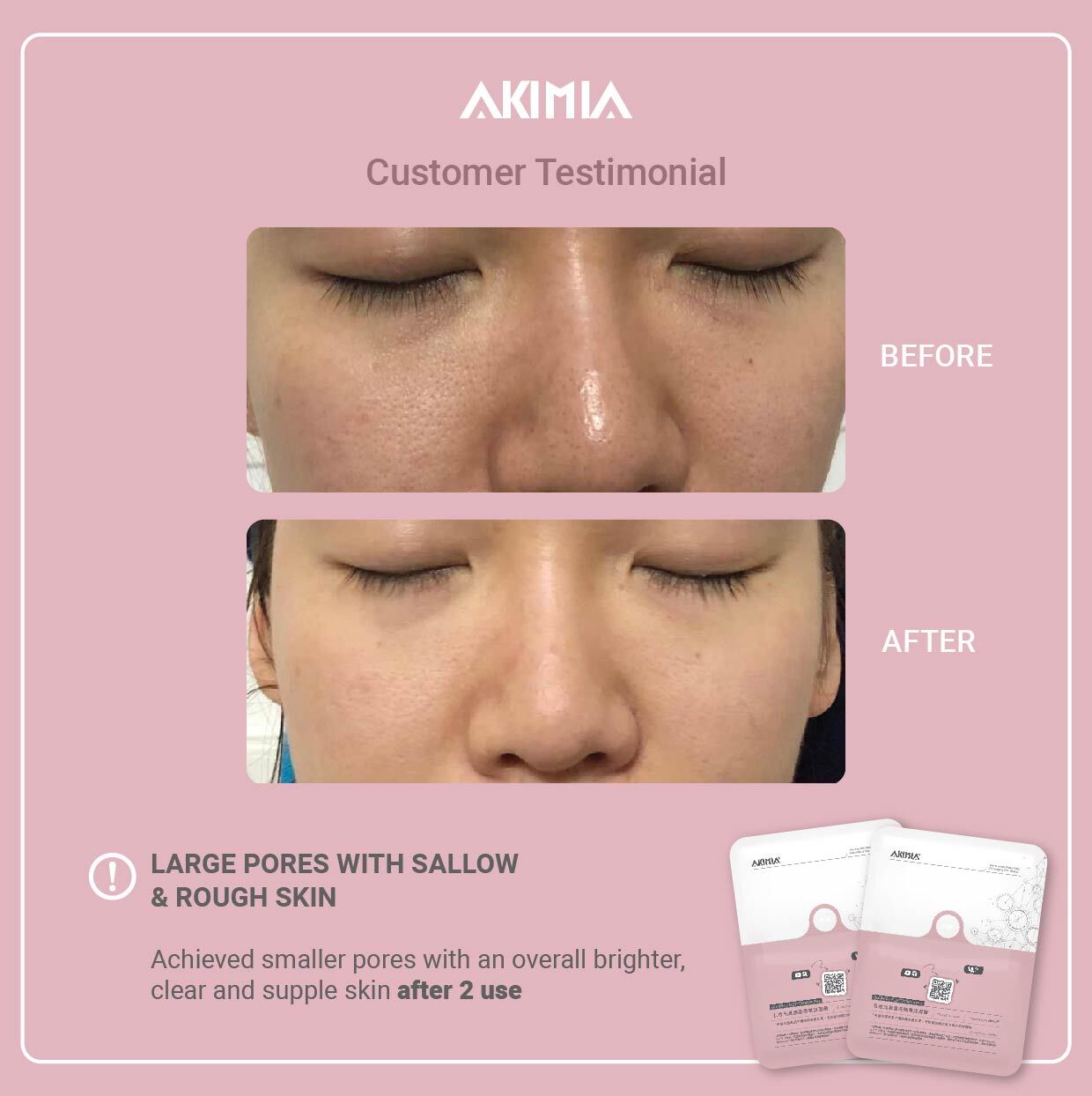 Akimia before and after_R1-06