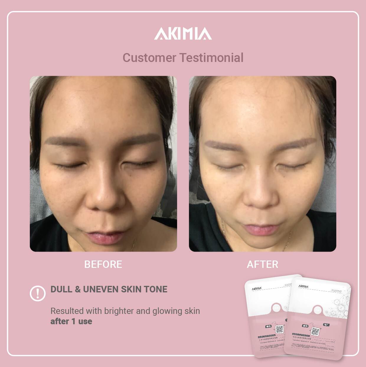 Akimia before and after_R1-08