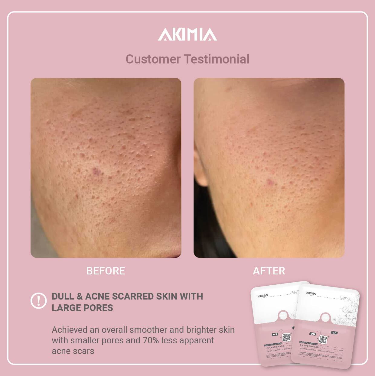 Akimia before and after_R1-11