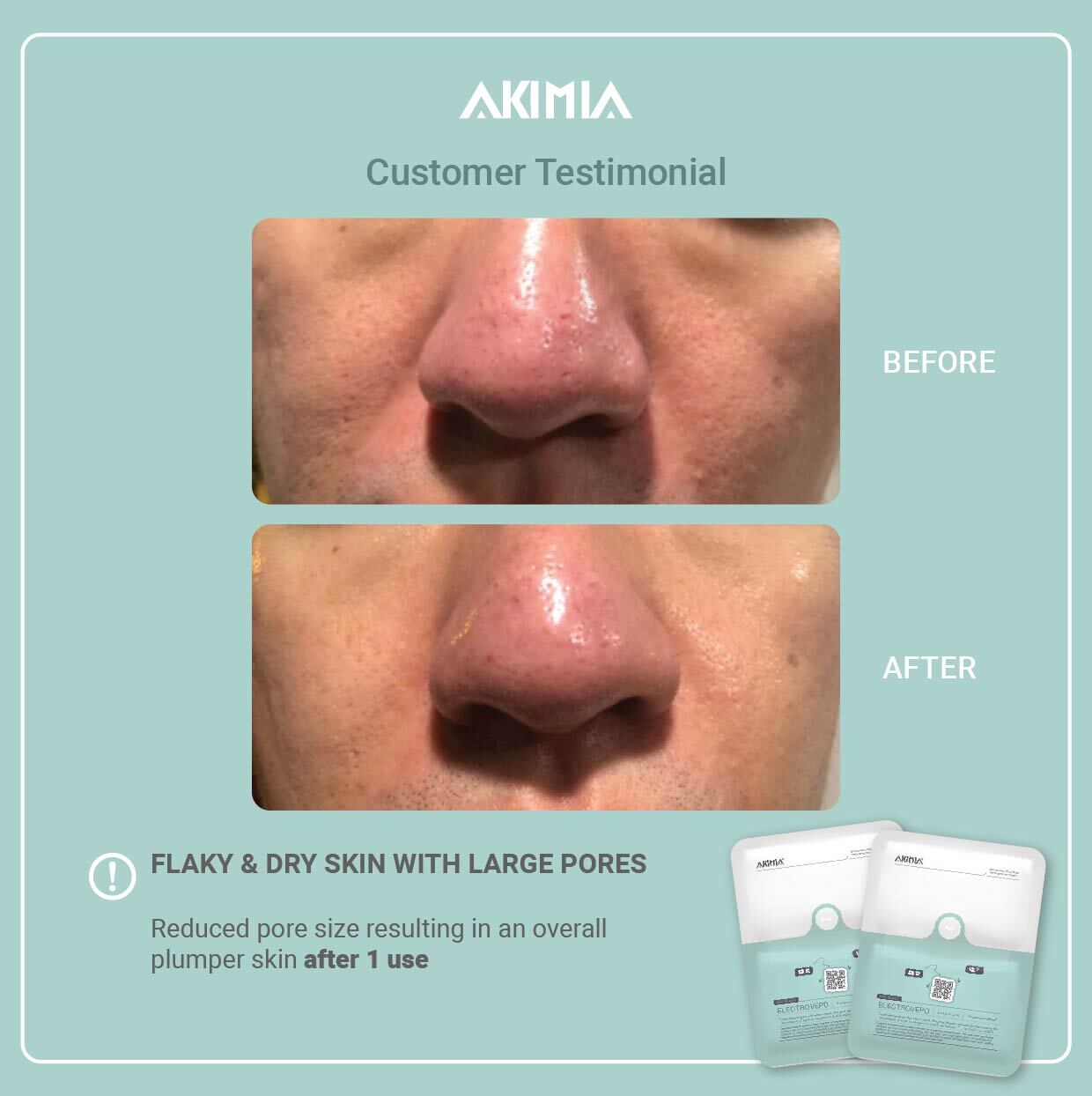 Akimia before and after_R1-25