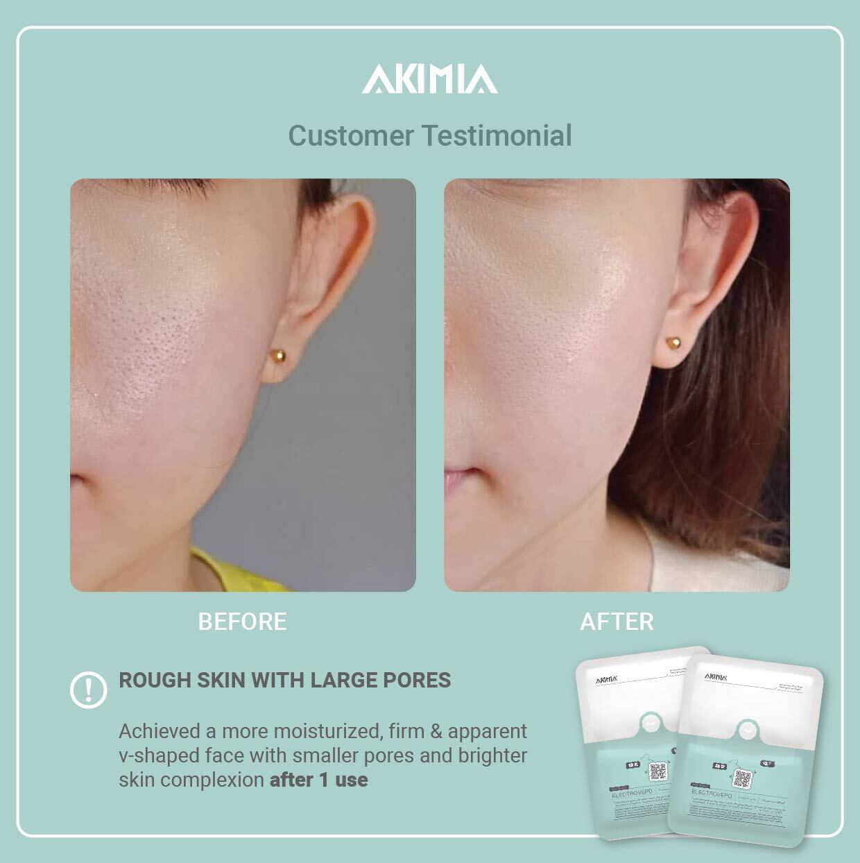 Akimia before and after_R1-27