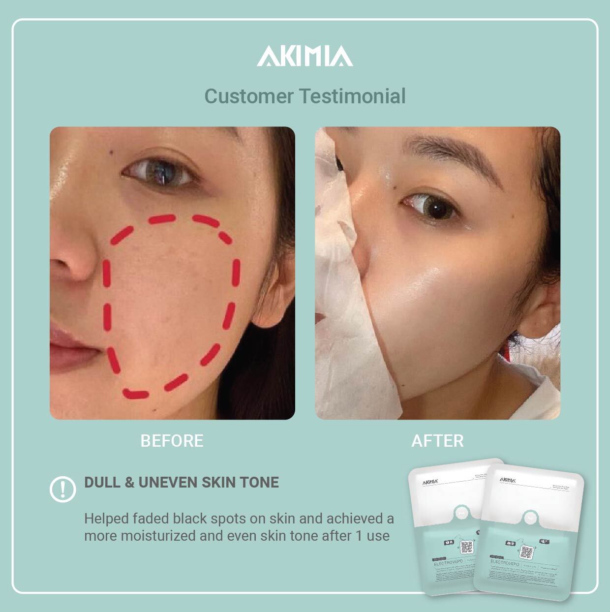 Akimia before and after_R1-26