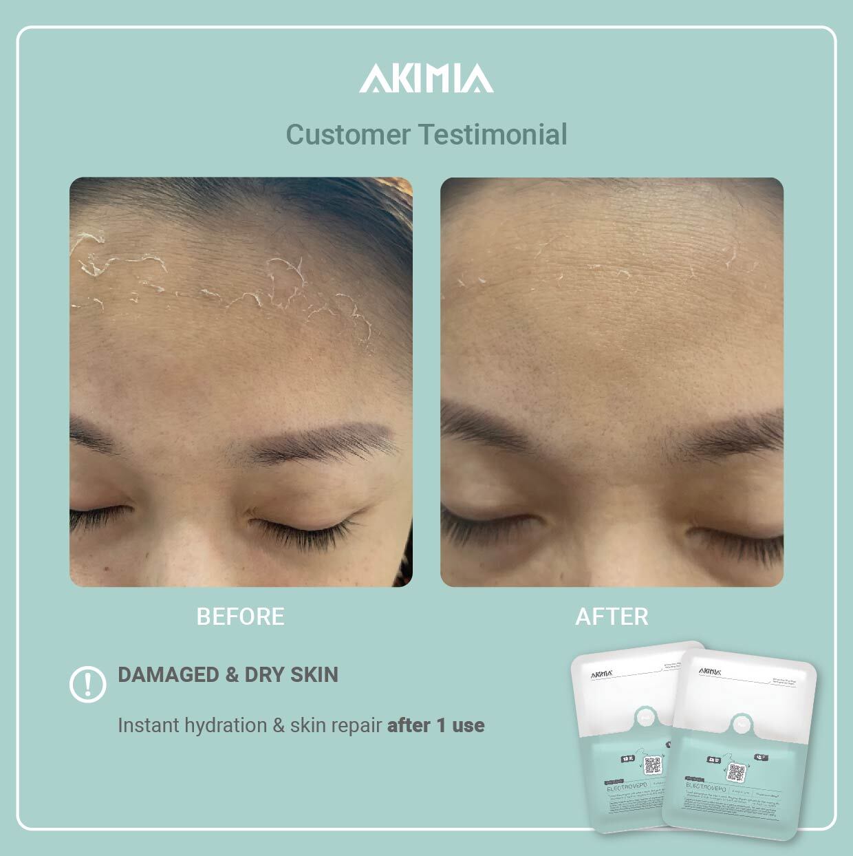 Akimia before and after_R1-28