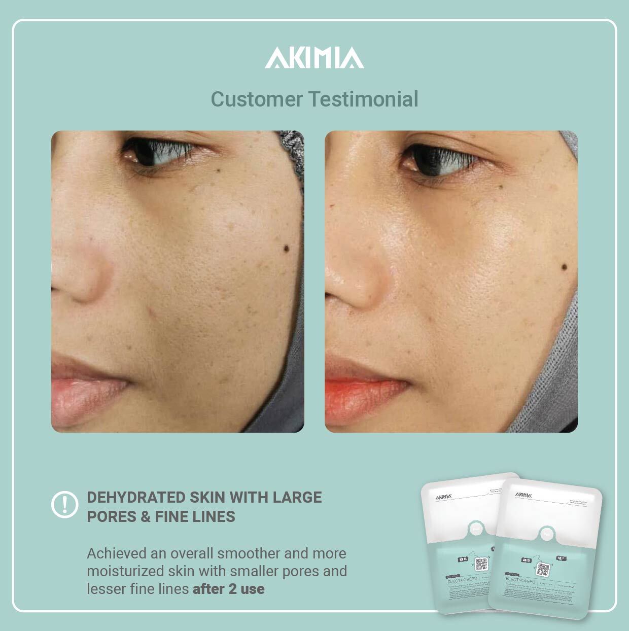 Akimia before and after_R1-24